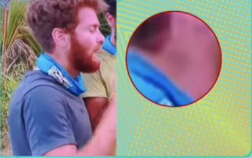Το σημάδι στον λαιμό του Τζέιμς πρόδωσε και το ειδύλλιο στο Survivor; (video)