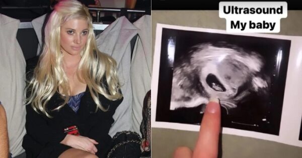 «Η εγκυμοσύνη δεν αντέχεται»: Η Τζούλια Αλεξανδράτου ποζάρει με μαγιό μετά την ανακοίνωση για τον πελαργό