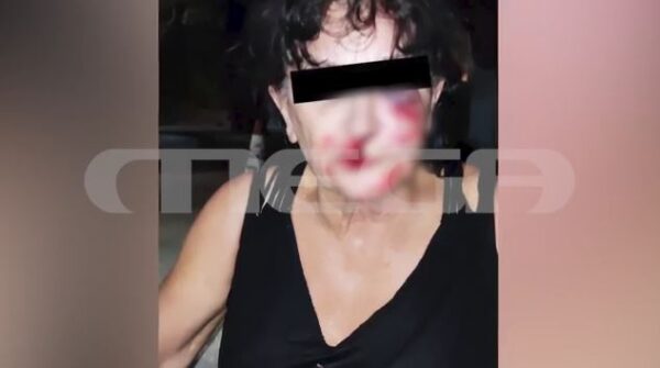 Αίγινα: Εξιχνιάστηκε το συμβόλαιο θανάτου πίσω από τον άγριο ξυλοδαρμό 67χρονης – Συγκλονιστική η μαρτυρία της  (video)