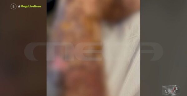 Μαρτυρία που σοκάρει: Αποφρακτικό  για το νεροχύτη εξερράγη πάνω στο σώμα της