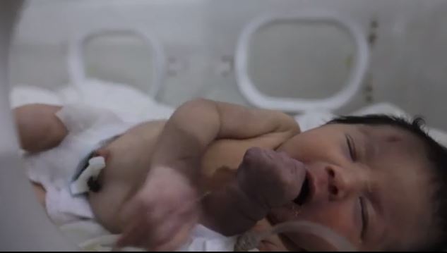 Συρία: Όλοι θέλουν να υιοθετήσουν τη μική Aya  που γεννήθηκε στα συντρίμμια αλλά η μητέρα της πέθανε (video)