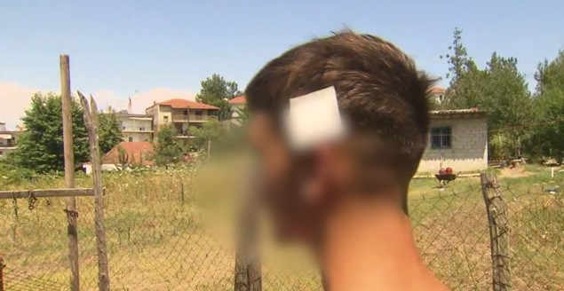 Χαλκιδική: 70χρονος πυροβόλησε τρείς ανήλικους – Τον ενοχλούσαν οι ομιλίες τους- Ο ένας νοσηλεύεται (video)