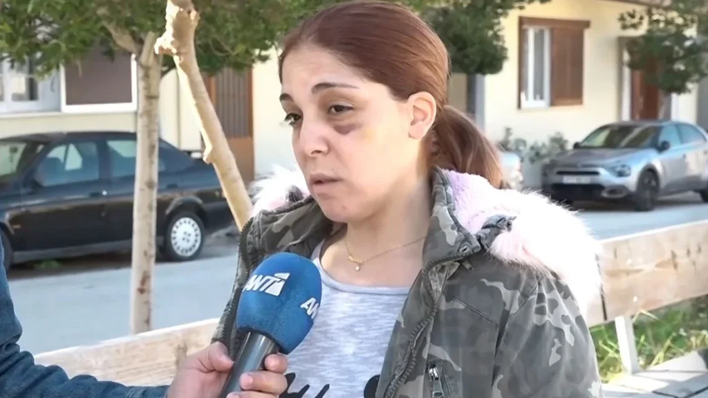 Άργος:  Με βίασε, με χτύπησε και απείλησε να κάψει ζωντανά τα παιδιά μας , λέει η 32χρονη για την άγρια κακοποίηση από τον σύντροφο της (βίντεο)