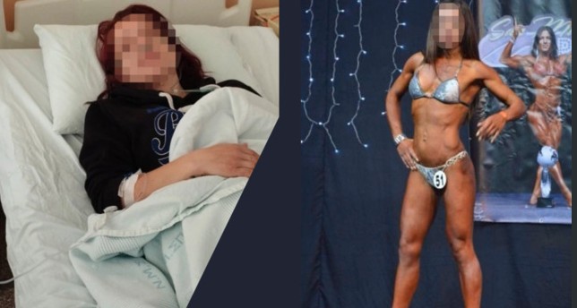 Σπάρτη: Άγριος ξυλοδαρμός γυναίκας πρώην bodybuilder από τον σύζυγό της – Νοσηλεύεται με κρανιογκεφαλικές κακώσεις
