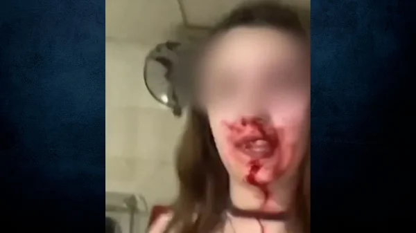 Άμφισσα: Γυναίκα με αίματα στο πρόσωπο καταγγέλλει ότι την ξυλοκόπησε ο σύζυγός της