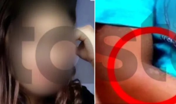 Λάρισα: «Δεν έπρεπε να έρθουμε, θα φέρουν την Αστυνομία γιατί είδαν τις πληγές» ,το μήνυμα της μητέρας που έκαιγε με τσιγάρα τα παιδιά της