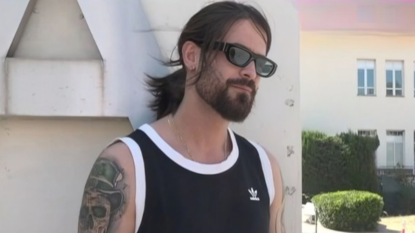 Άρης Μουγκοπέτρος: Κάνει έκκληση να σβηστούν από το διαδίκτυο φωτογραφίες με το τραυματισμένο χέρι του