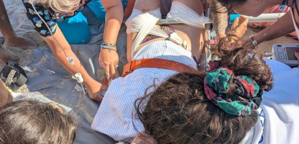 Ατύχημα στη Δονούσα: Κολυμπώντας έφτασαν στην παραλία γιατρός και νοσηλεύτρια για τη γυναίκα που τραυματίστηκε από ομπρέλα – Τι λέει το υπουργείο Υγείας