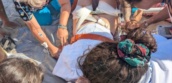 Ατύχημα στη Δονούσα: Κολυμπώντας έφτασαν στην παραλία γιατρός και νοσηλεύτρια για τη γυναίκα που τραυματίστηκε από ομπρέλα – Τι λέει το υπουργείο Υγείας