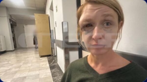 Κορωπί: Σοκάρει η εικόνα της 40χρονης που ξυλοκοπήθηκε – «Δεν πιστεύω ότι μου επιτέθηκε ο σύντροφός μου, έχουμε σχέση αγάπης,  μπορεί οι γείτονες» λέει