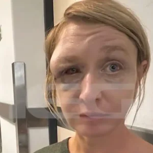 Κορωπί: Σοκάρει η εικόνα της 40χρονης που ξυλοκοπήθηκε – «Δεν πιστεύω ότι μου επιτέθηκε ο σύντροφός μου, έχουμε σχέση αγάπης,  μπορεί οι γείτονες» λέει