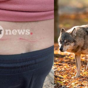 «Μου έσκισε  τα ρούχα, μου έκανε γρατζουνιές»,  λέει ο άνδρας που του επιτέθηκε λύκος στο Τατόϊ – Πως σώθηκε – Οδηγίες προστασίας (βίντεο)