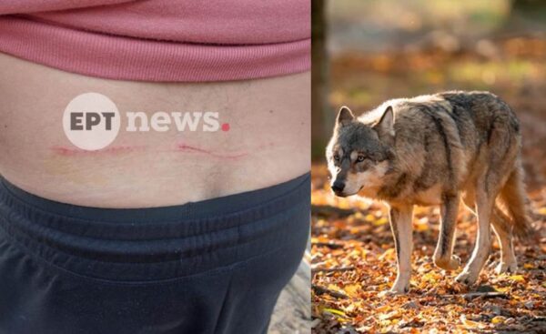 «Μου έσκισε  τα ρούχα, μου έκανε γρατζουνιές»,  λέει ο άνδρας που του επιτέθηκε λύκος στο Τατόϊ – Πως σώθηκε – Οδηγίες προστασίας (βίντεο)