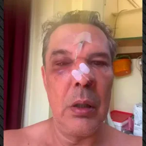 Χαϊδάρι: «Μίλαγε σε δύο κινητά μέσα στο ιατρείο, και όταν  του έκανα παρατήρηση με πλάκωσε στο ξύλο», λέει ο άνδρας που ξυλοκοπήθηκε άγρια(βίντεο)