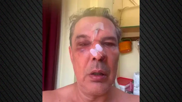 Χαϊδάρι: «Μίλαγε σε δύο κινητά μέσα στο ιατρείο, και όταν  του έκανα παρατήρηση με πλάκωσε στο ξύλο», λέει ο άνδρας που ξυλοκοπήθηκε άγρια(βίντεο)