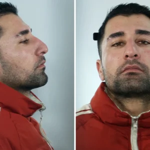 Θεσσαλονίκη: Στη δημοσιότητα τα στοιχεία του 23χρονου Αφγανού που έδινε ναρκωτικά και αλκοόλ σε ανήλικες και τις βίαζε