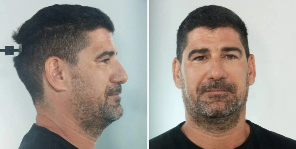Στη δημοσιότητα τα στοιχεία του  προπονητή στην Κεφαλονιά που διώκεται για βιασμούς ανήλικων αθλητριών