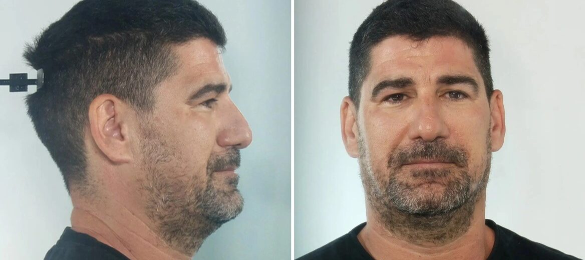 Στη δημοσιότητα τα στοιχεία του  προπονητή στην Κεφαλονιά που διώκεται για βιασμούς ανήλικων αθλητριών