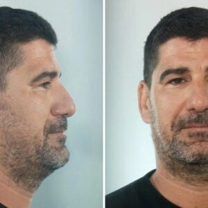 Στη δημοσιότητα τα στοιχεία του  προπονητή στην Κεφαλονιά που διώκεται για βιασμούς ανήλικων αθλητριών